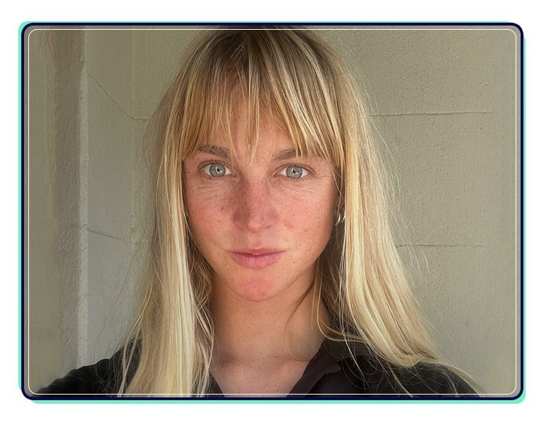 Kaisea Button -- Decoration Image 1